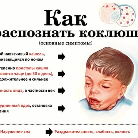 Коклюш!!!